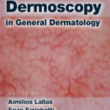 (eBook PDF) Dermoscopy in General Dermatology by Aimilios Lallas , Enzo Errichetti , Dimitrios Ioannides