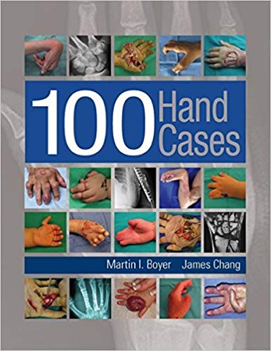 (eBook PDF)100 Hand Cases by Martin Boyer , James Chang