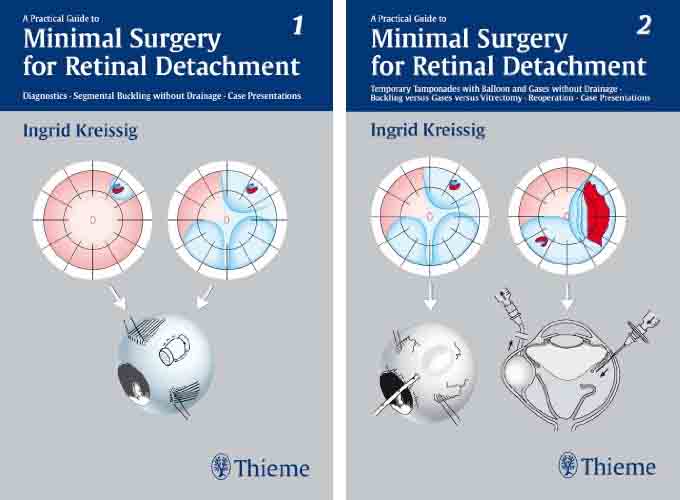 (eBook PDF)A Practical Guide to Minimal Surgery for Retinal Detachment, Volume I and 2 by Ingrid Kreissig