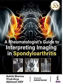 (eBook PDF)A Rheumatologist S Guide To Interpreting Imaging In Spondyloarthritis by Ashish Sharma , Vivek Arya , Abhinetri KSV