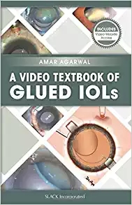 (eBook PDF)A Video Textbook of Glued IOLs by Amar Agarwal MS FRCS FRCOphth
