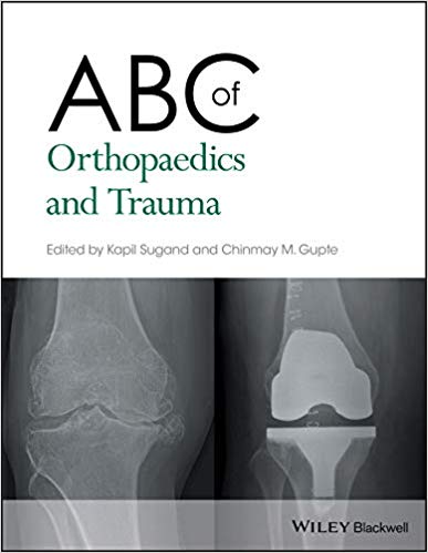 (eBook PDF)ABC of Orthopaedics and Trauma by Kapil Sugand , Chinmay M. Gupte