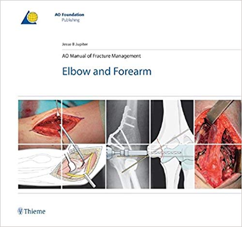 (eBook PDF)AO Manual of Fracture Management Elbow and Forearm, 1e  by Jesse Jupiter , AO Publishing