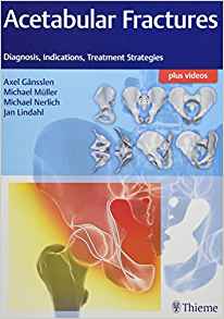 (eBook PDF)Acetabular Fractures Diagnosis, Indications, Treatment Strategies (PDF+VIDEOS) by Axel Gänsslen , Michael Müller , Michael Nerlich , Jan Lindahl