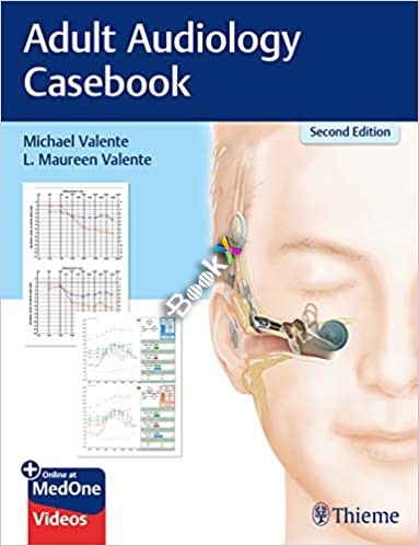 (eBook PDF)Adult Audiology Casebook 2nd Edition PDF+VIDEOS by Michael Valente , L. Maureen Valente