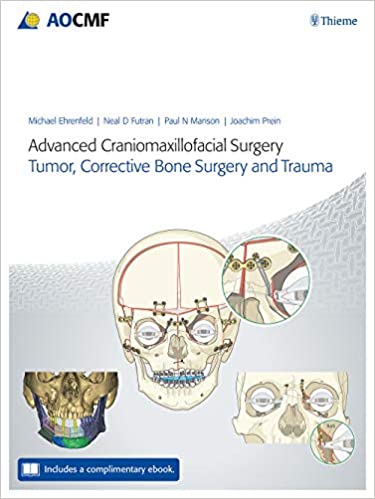 (eBook PDF)Advanced Craniomaxillofacial Surgery by Michael Ehrenfeld , Neal D. Futran , Paul N. Manson  Thieme; Illustrated Edition (September 16, 2020)