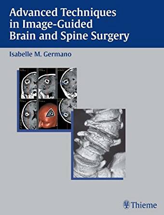 (eBook PDF)Advanced Techniques in Image-Guided Brain and Spine Surgery, 1e by Isabelle M. Germano