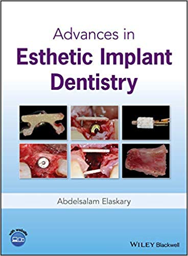 (eBook PDF)Advances in Esthetic Implant Dentistry by Abdelsalam Elaskary