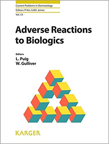 (eBook PDF)Adverse Reactions to Biologics by L. Puig , W. Gulliver , P. Itin (Series Editor), G.B.E. Jemec (Series Editor)