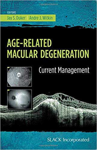 (eBook PDF)Age-Related Macular Degeneration