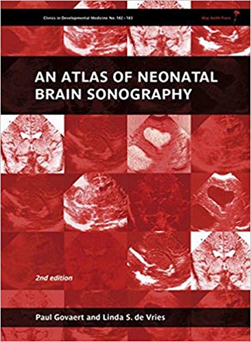 (eBook PDF)An Atlas of Neonatal Brain Sonography, 2nd Edition by Paul Govaert , Linda S. de Vries