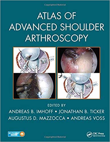 (eBook PDF)Atlas of Advanced Shoulder Arthroscopy by Andreas B. Imhoff , Jonathan B. Ticker , Augustus D. Mazzocca , Andreas Voss