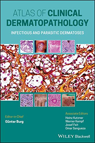 (eBook PDF)Atlas of Clinical Dermatopathology by Günter Burg