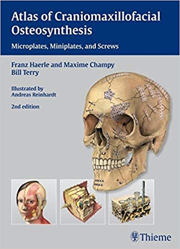 (eBook PDF)Atlas of Craniomaxillofacial Osteosynthesis by Franz Härle , Maxime Champy , Bill Terry