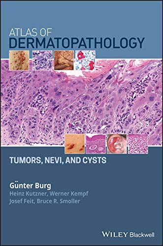 (eBook PDF)Atlas of Dermatopathology: Tumors, Nevi, and Cysts by Gunter Burg , Heinz Kutzner , Werner Kempf , Josef Feit , Bruce R. Smoller