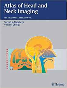 (eBook PDF)Atlas of Head and Neck Imaging - The Extracranial Head and Neck by Suresh Kumar Mukherji , Vincent Chong