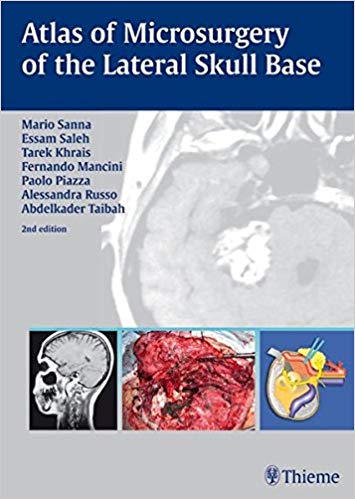 (eBook PDF)Atlas of Microsurgery of the Lateral Skull Base, 2e  by Mario Sanna , Essam A. Saleh , Paolo Piazza , Alessandra Russo , Abdelkader Taibah , Fernando Mancini , Tarek Khrais