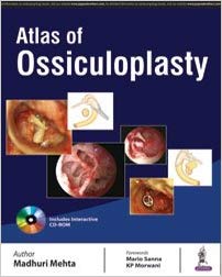 (eBook PDF)Atlas of Ossiculoplasty by Madhuri Mehta