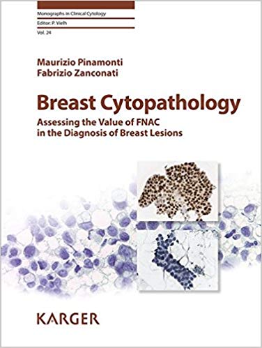 (eBook PDF)Breast Cytopathology - Assessing the Value of FNAC in the Diagnosis of Breast Lesions by M. Pinamonti , F. Zanconati , P. Vielh (Series Editor)