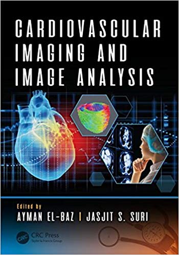 (eBook PDF)Cardiovascular Imaging and Image Analysis by Ayman El-Baz , Jasjit S. Suri