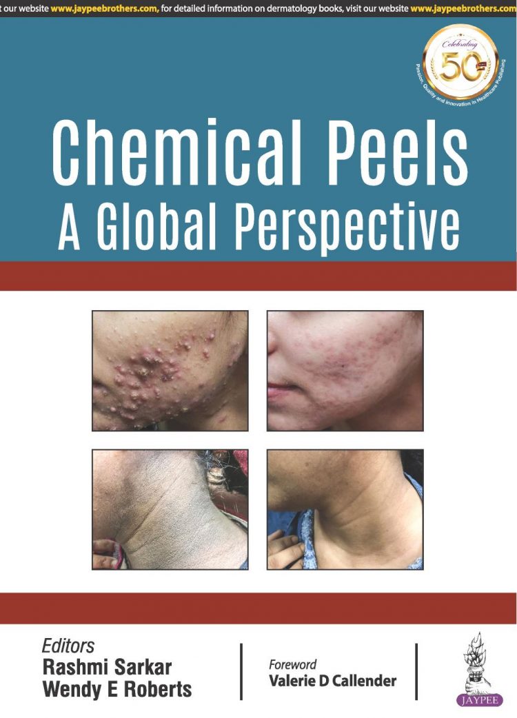 (eBook PDF)Chemical Peels: A Global Perspective 1st Edition by Rashmi Sarkar  , Wendy E Roberts , Sneha Ghunawat , Ishad Aggarwal , Zubin K Mandlewala