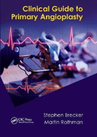 (eBook PDF)Clinical Guide to Primary Angioplasty 1st Edition by Stephen Brecker , Martin Rothman