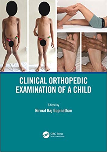 (eBook PDF)Clinical Orthopedic Examination of a Child by Nirmal Raj Gopinathan