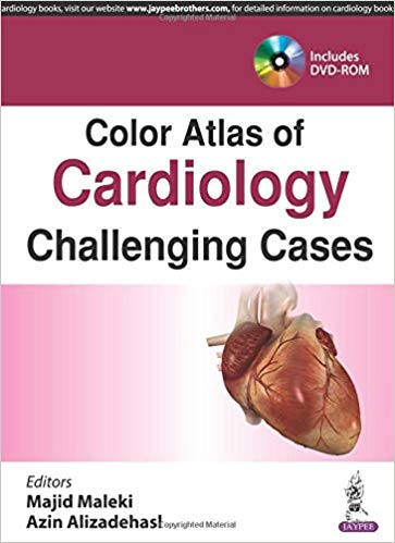 (eBook PDF)Color Atlas of Cardiology- Challenging Cases by Majid Maleki , Azin Alizadehasl