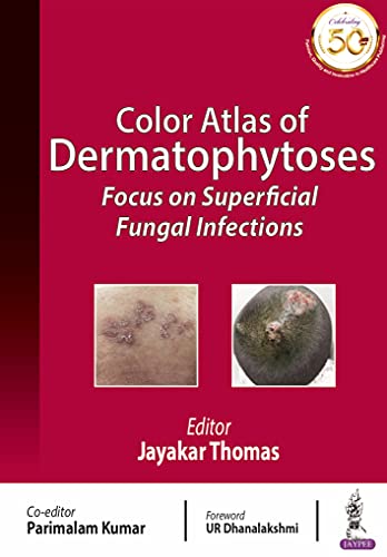(eBook PDF)Color Atlas of Dermatophytoses Focus on Superficial Fungal Infections by Jayakar Thomas