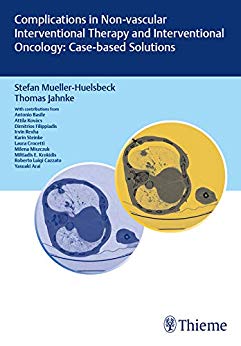 (eBook PDF)Complications in Non-vascular lnterventional Therapy and lnterventional Oncology Cased-based Solutions by Stefan Mueller-Huelsbeck , Thomas Jahnke