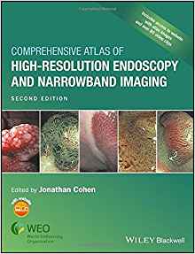 (eBook PDF)Comprehensive Atlas of High Resolution Endoscopy and Narrowband Imaging, 2nd Edition  by Jonathan Cohen