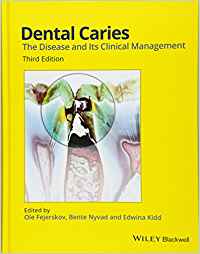 (eBook PDF)Dental Caries: The Disease and Its Clinical Management 3rd Edition by Ole Fejerskov , Bente Nyvad , Edwina Kidd
