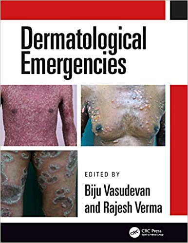 (eBook PDF)Dermatological Emergencies  by Rajesh Verma , Biju Vasudevan