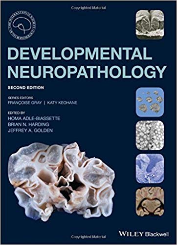 (eBook PDF)Developmental Neuropathology 2nd Edition by Homa Adle-Biassette ,‎ Brian N. Harding ,‎ Jeffrey A. Golden