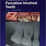 (eBook PDF)Diagnosis and Treatment of Furcation-Involved Teeth by Luigi Nibali