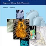 (eBook PDF)Diagnostic Imaging of Congenital Heart Defects by Matthias Gutberlet
