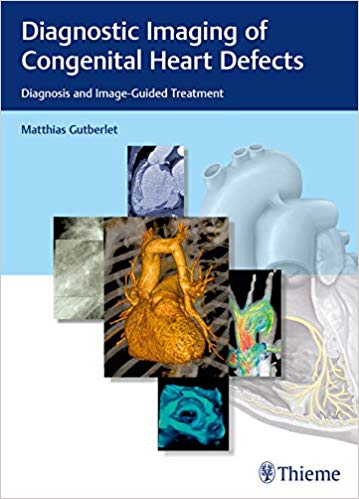 (eBook PDF)Diagnostic Imaging of Congenital Heart Defects by Matthias Gutberlet