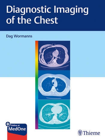 (eBook PDF)Diagnostic Imaging of the Chest