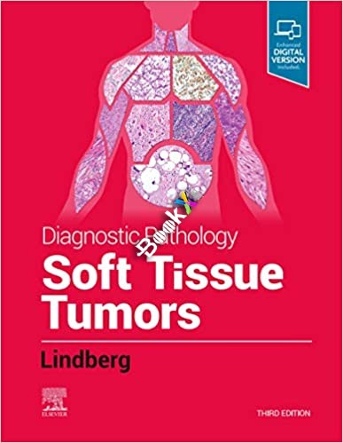 (eBook PDF)Diagnostic Pathology Soft Tissue Tumors 3rd Edition by Matthew R. Lindberg MD