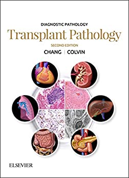 (eBook PDF)Diagnostic Pathology Transplant Pathology E-Book 2nd Edition by Anthony C. Chang , Matthew R Lindberg
