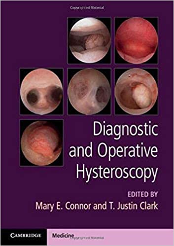 (eBook PDF)Diagnostic and Operative Hysteroscopy PDF+VIDEOS by Mary Connor , Justin Clark  Cambridge University Press; 1st Edition (August 13, 2020)