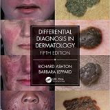 (eBook PDF)Differential Diagnosis in Dermatology 5th Edition by Richard Ashton, Barbara Leppard