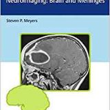 (eBook PDF)Differential Diagnosis in Neuroimaging - Brain and Meninges by Steven P. Meyers