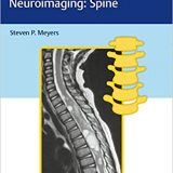 (eBook PDF)Differential Diagnosis in Neuroimaging: Spine by Steven Meyers