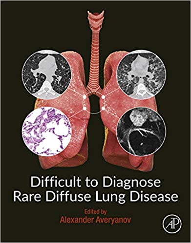 (eBook PDF)Difficult to Diagnose Rare Diffuse Lung Disease by Alexander V. Averyanov