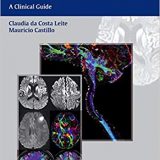 (eBook PDF)Diffusion Weighted and Diffusion Tensor Imaging by Claudia Leite , Mauricio Castillo