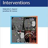 (eBook PDF)Digestive Disease Interventions by Baljendra S. Kapoor , Jonathan M. Lorenz