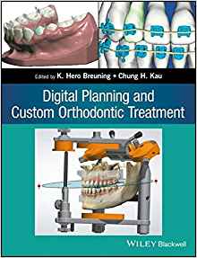 (eBook PDF)Digital Planning and Custom Orthodontic Treatment by K. Hero Breuning , Chung H. Kau