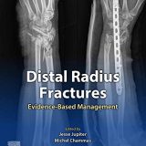 (eBook PDF)Distal Radius Fractures Evidence-Based Management by Geert Alexander Buijze , Jesse Jupiter , Michel Chammas