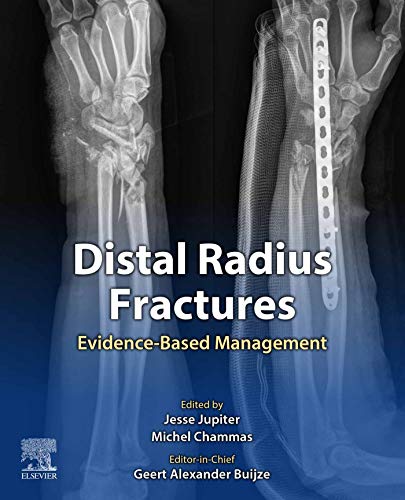 (eBook PDF)Distal Radius Fractures Evidence-Based Management by Geert Alexander Buijze , Jesse Jupiter , Michel Chammas